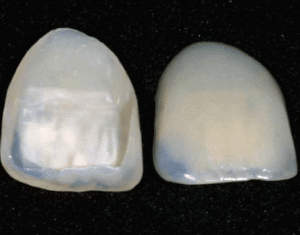 X | Bellingham Dentist | Dental Implants | Northside Dental Care X | Bellingham Dentist | Dental Implants | Northside Dental Care