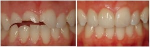 X | Bellingham Dentist | Dental Implants | Northside Dental Care X | Bellingham Dentist | Dental Implants | Northside Dental Care