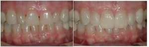 X | Bellingham Dentist | Dental Implants | Northside Dental Care X | Bellingham Dentist | Dental Implants | Northside Dental Care