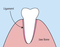 Extractions | Bellingham Dentist | Dental Implants | Northside Dental Care Extractions | Bellingham Dentist | Dental Implants | Northside Dental Care