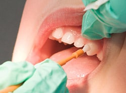 Flouride Pediatric | Bellingham Dentist | Dental Implants | Northside Dental Care Flouride Pediatric | Bellingham Dentist | Dental Implants | Northside Dental Care