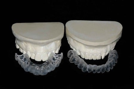Whitening Tray | Bellingham Dentist | Dental Implants | Northside Dental Care Whitening Tray | Bellingham Dentist | Dental Implants | Northside Dental Care