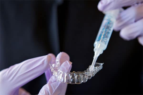 Whitening Tray | Bellingham Dentist | Dental Implants | Northside Dental Care Whitening Tray | Bellingham Dentist | Dental Implants | Northside Dental Care