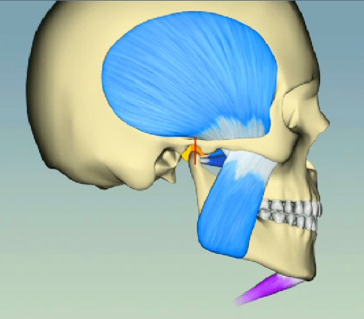 Tmj Tmd | Bellingham Dentist | Dental Implants | Northside Dental Care